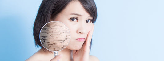 10 Tips for Defeating Dry Skin
